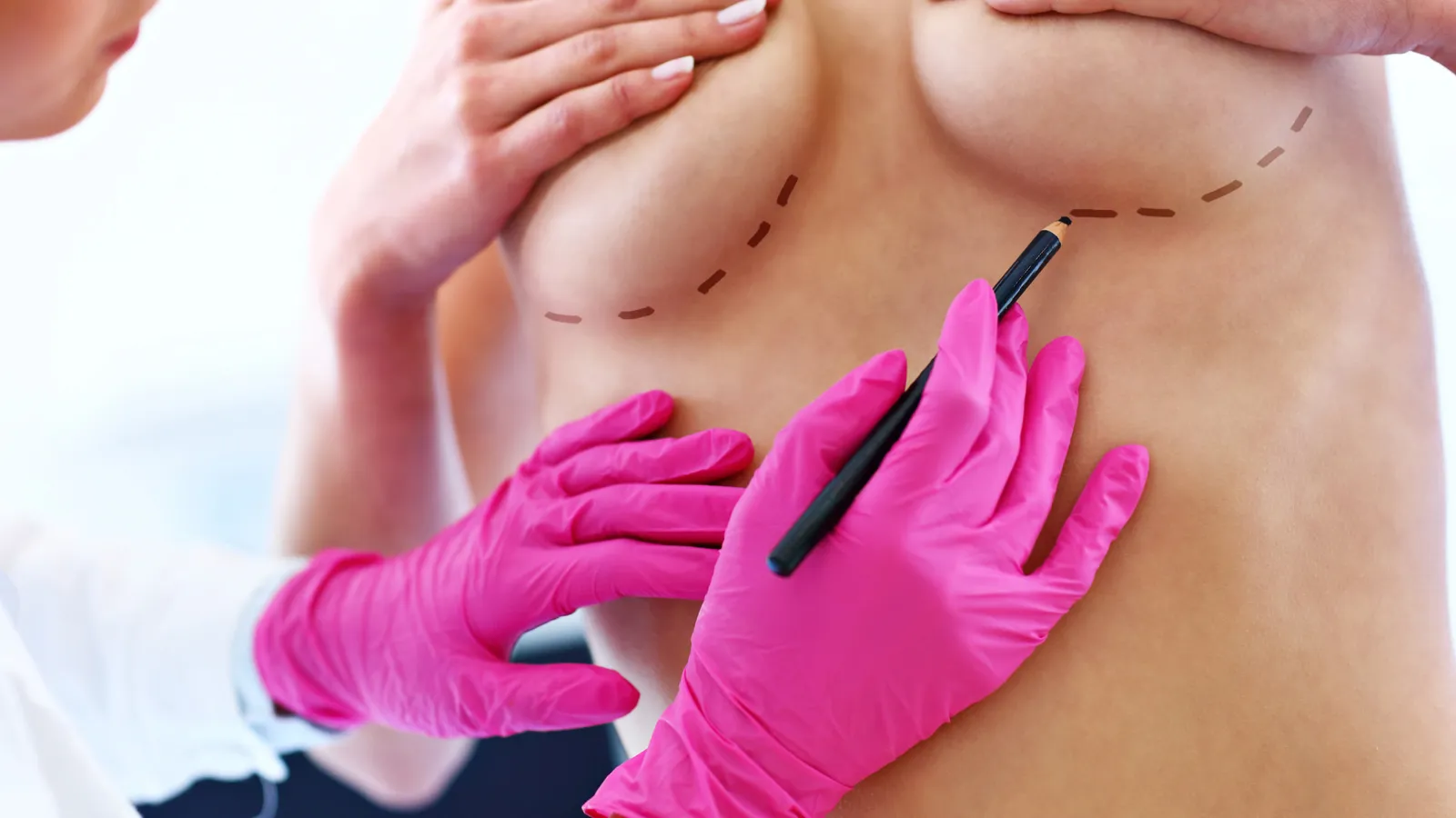 Safe plastic surgery abroad: Tips for choosing a surgeon, clinic and safe destination