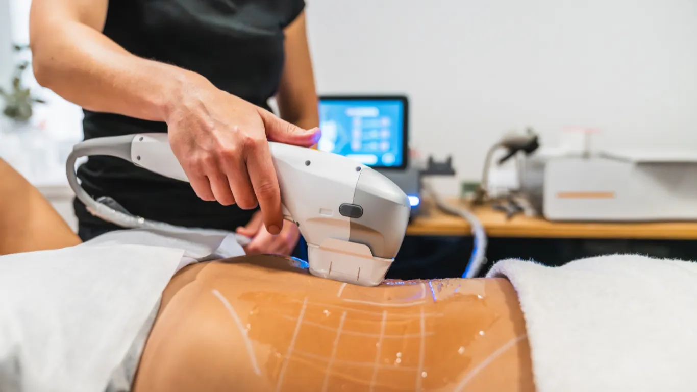 Lipo 360: Real Benefits, Visible Changes, and Recovery Time