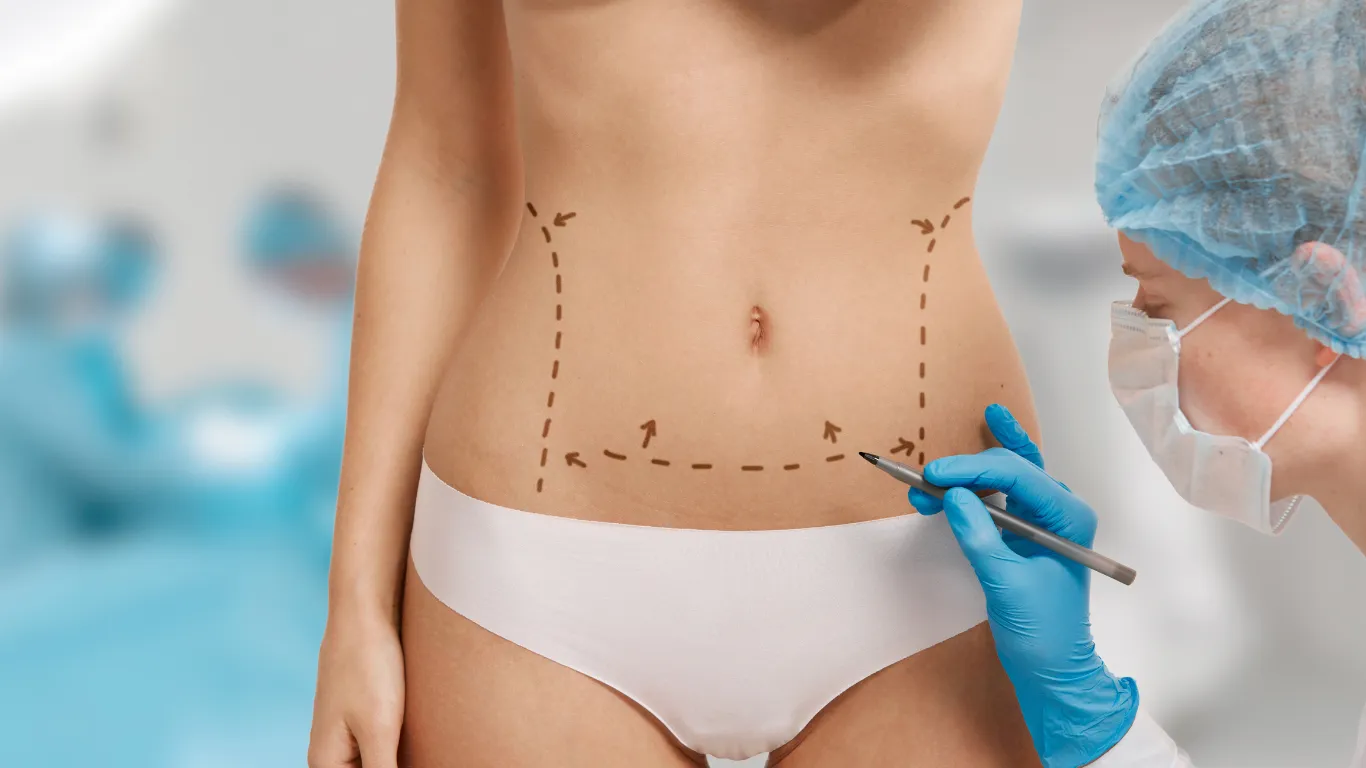 Lipoabdominoplasty Recovery Process: What to Expect Step by Step