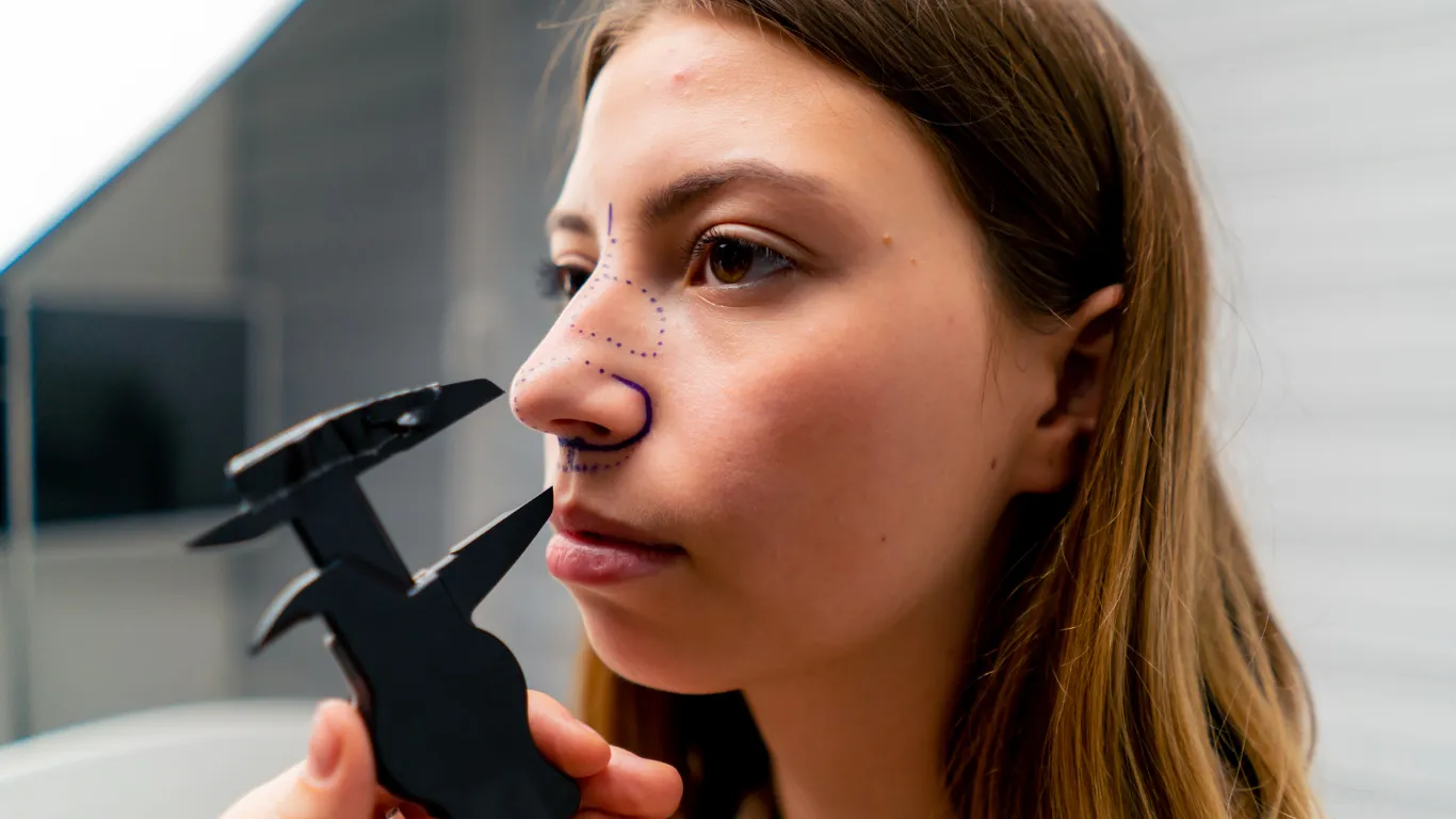 Closed or Open Rhinoplasty: Understanding Surgical Approaches