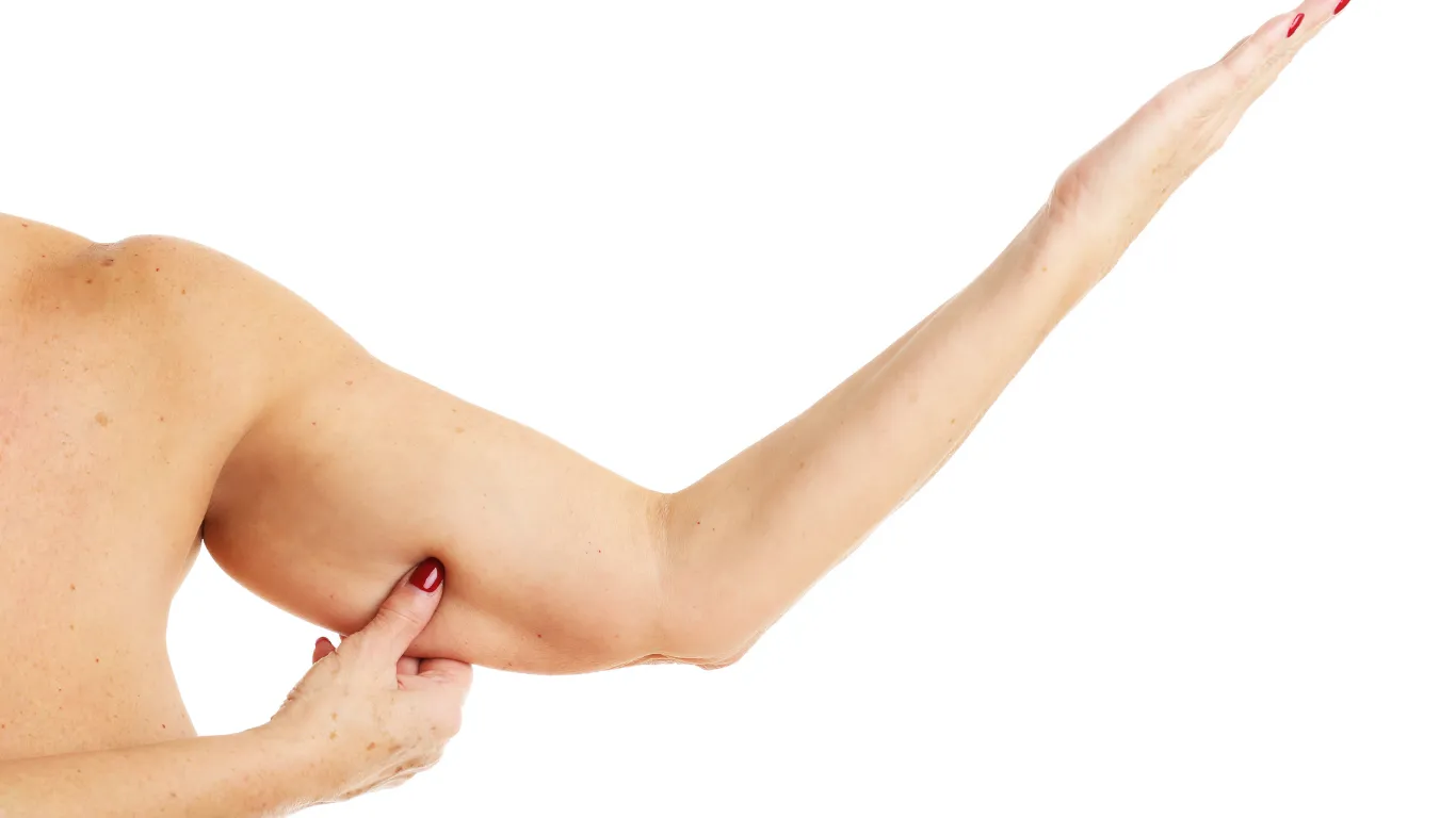 Arm liposuction: visible silhouette improvement
