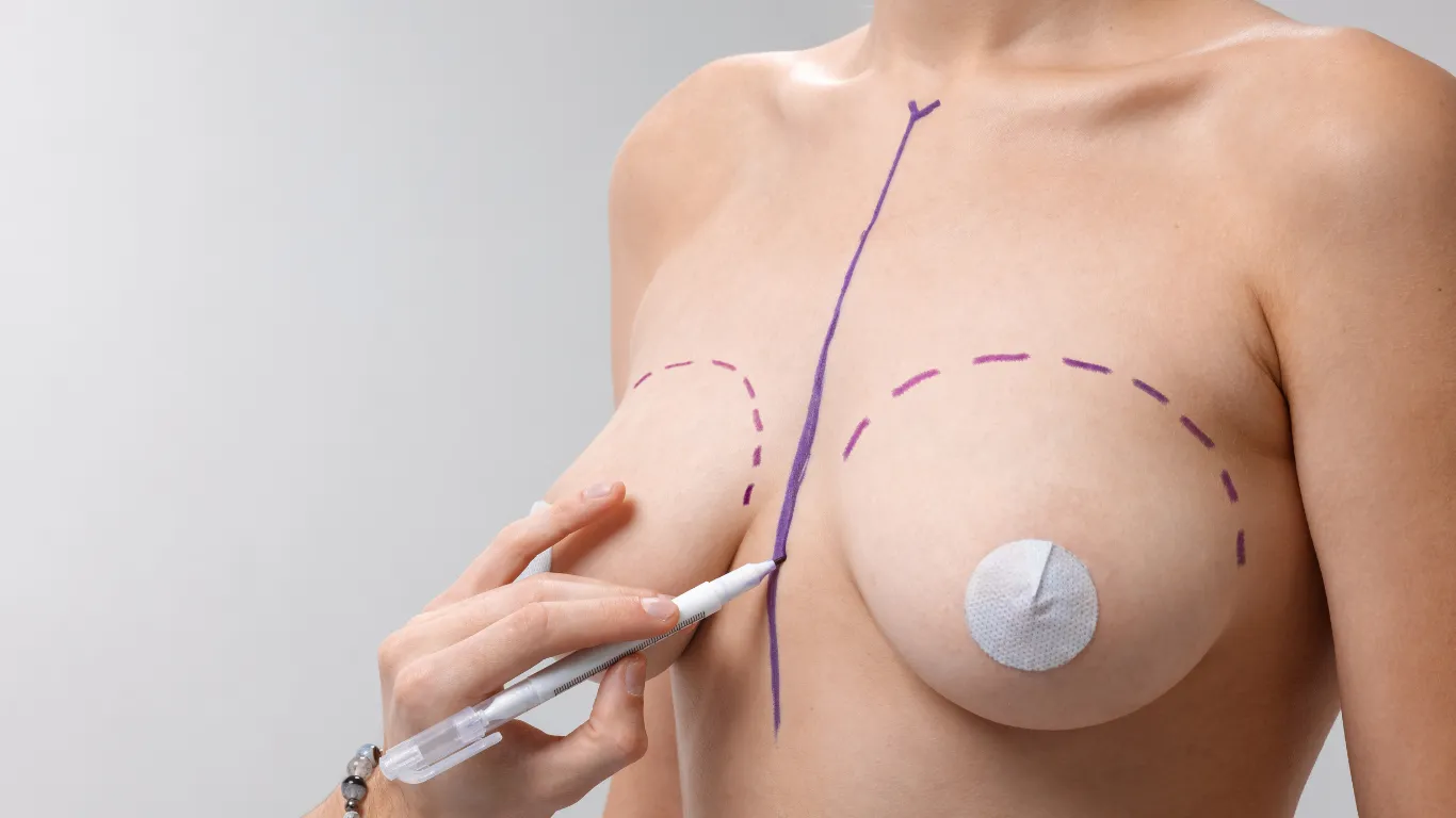 Breast reshaping surgery, options for improving breast shape