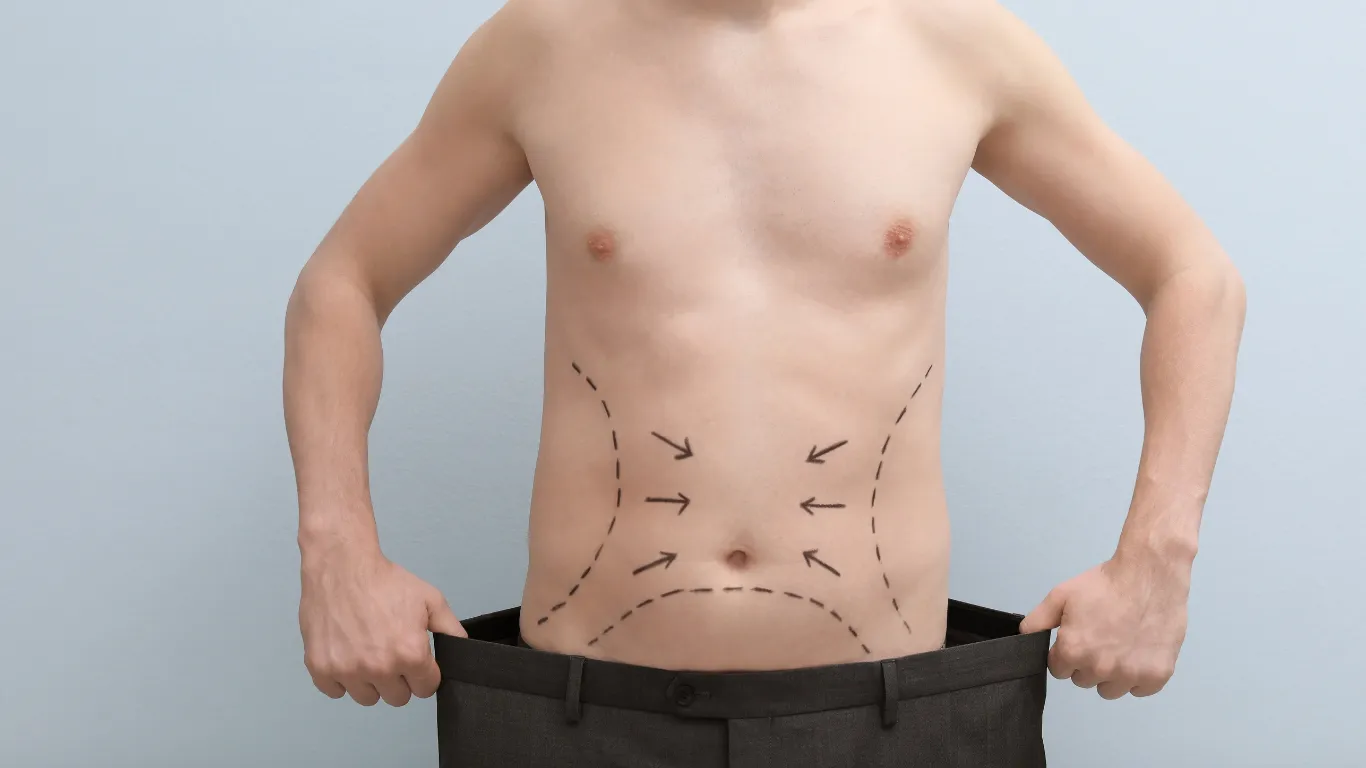 Liposuction for men, body contouring for male patients